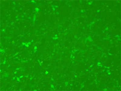 荧光显微镜¤背景太绿怎么调