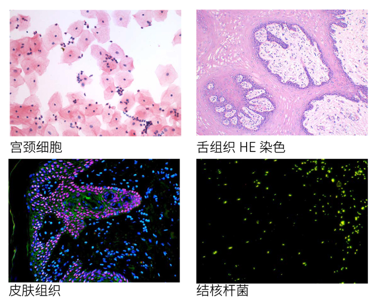 病理研究用显微镜NE900系列_FISH 荧光〖成像系统