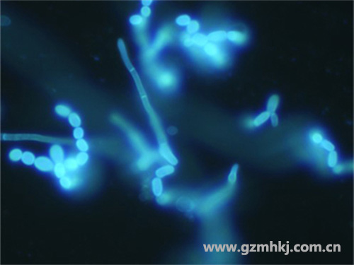 MHF100荧光显微镜下观察的皮肤真∮菌1 广州�y明慧显微
